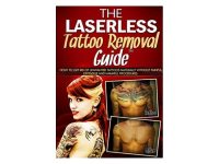 laserless tattoo removal