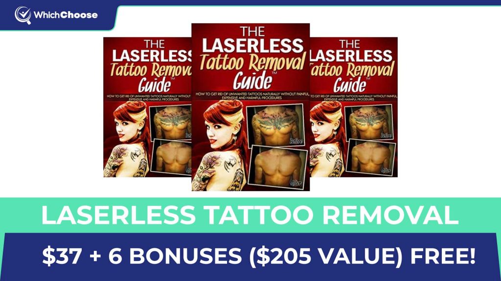 How Much Does The Laserless Tattoo Removal Cost?