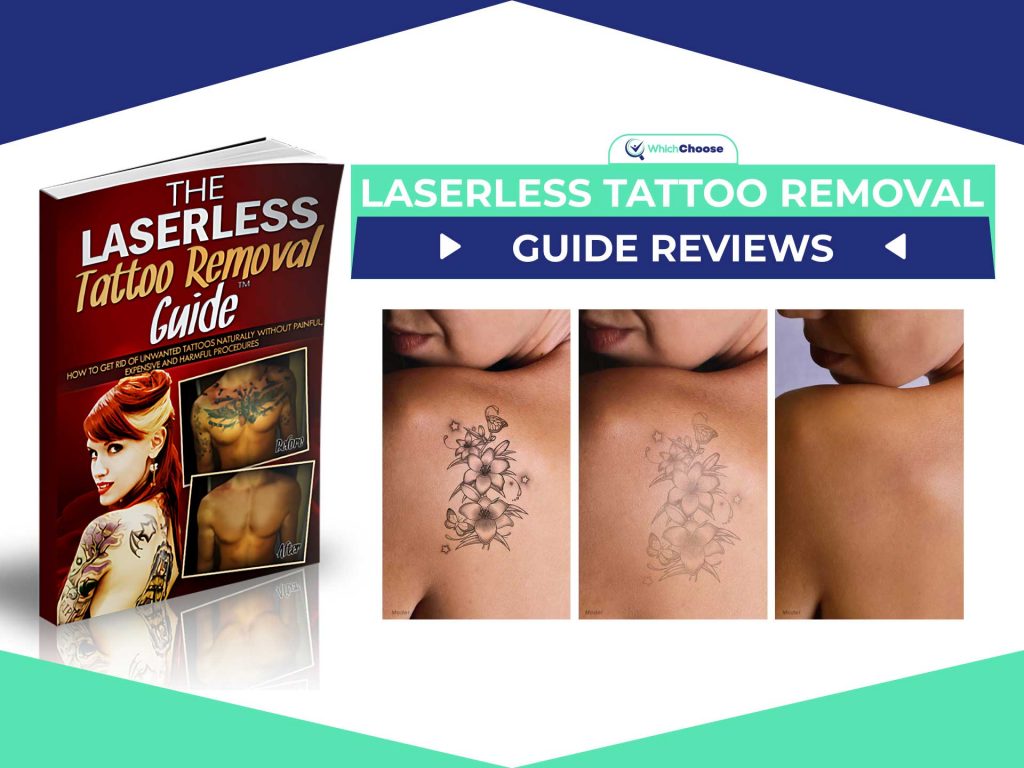 laserless tattoo removal