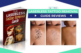 laserless tattoo removal